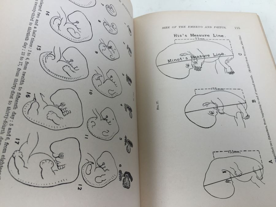 A Manual Of Obstetrics By A. F. A. King 1910 With Items From Original Book Owner From 1911 [Photo 8]