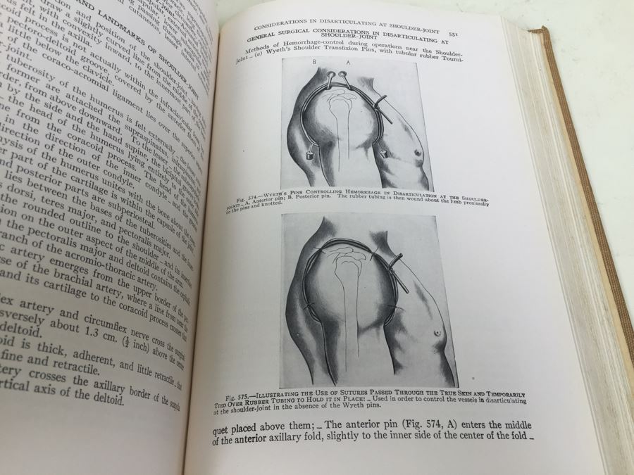 Operative Surgery By Warren Stone Bickham 1942 W. B. Saunders Company Philadelphia [Photo 20]