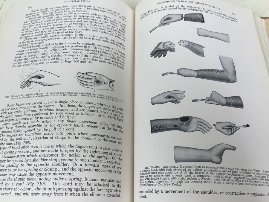 Operative Surgery By Warren Stone Bickham 1942 W. B. Saunders Company Philadelphia [Photo 22]