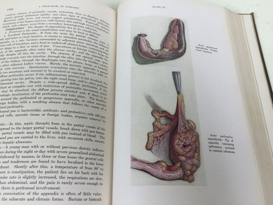 Text-Book Of Surgery Babcock 1930 W. B. Saunders Company Philadelphia [Photo 13]