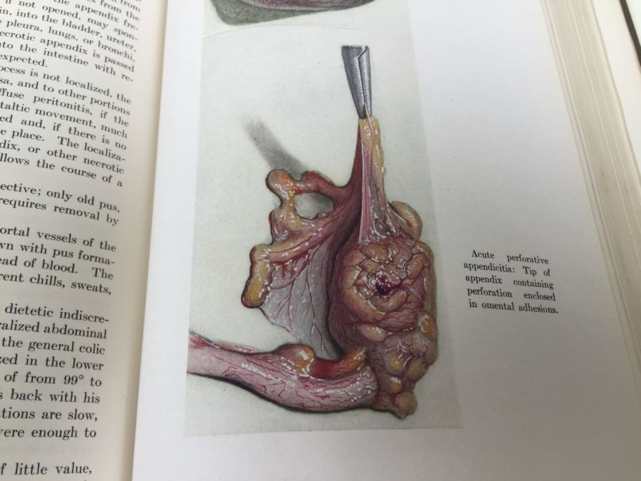 Text-Book Of Surgery Babcock 1930 W. B. Saunders Company Philadelphia [Photo 14]
