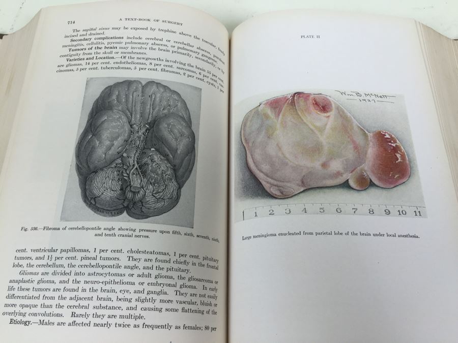 Text-Book Of Surgery Babcock 1930 W. B. Saunders Company Philadelphia [Photo 3]