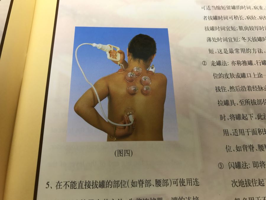 Kangzhu Chinese Cupping Therapy Set With Extra Cups [Photo 21]