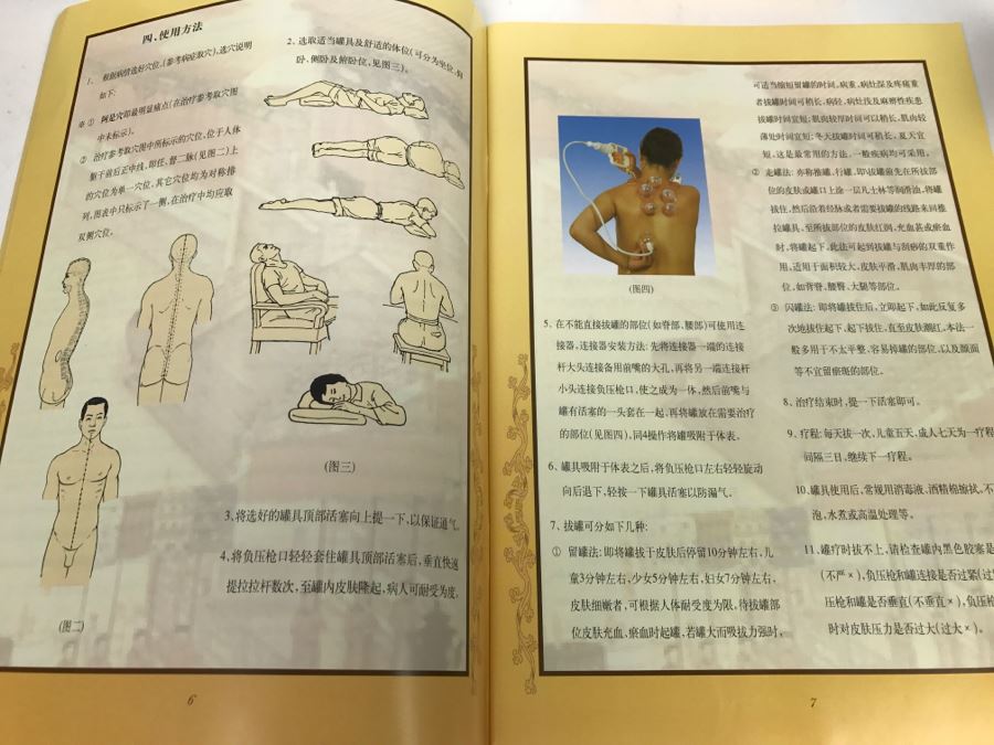 Kangzhu Chinese Cupping Therapy Set With Extra Cups [Photo 20]