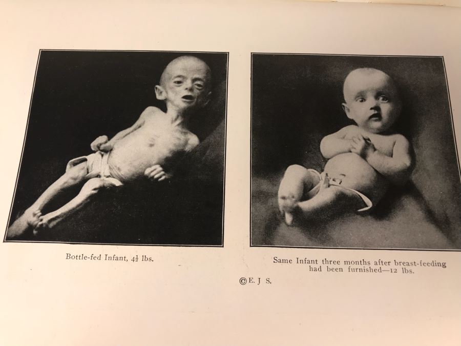 Impressive 1916 Hardcover Book - Library Of Health Complete Guide To Prevention And Cure Of Disease Twenty Books - One Volume By B. Frank Scholl 1,774 Pages With Many Illustrations [Photo 24]