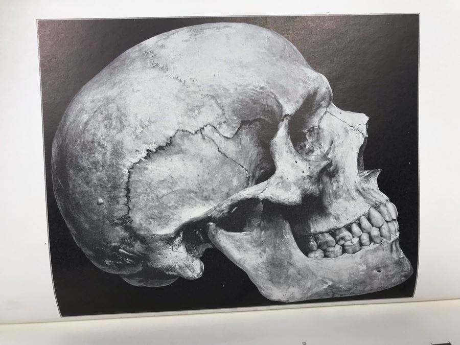 Vintage 1941 Exodontia Dental Book By M. Hillel Feldman, DDS With Original Box [Photo 5]