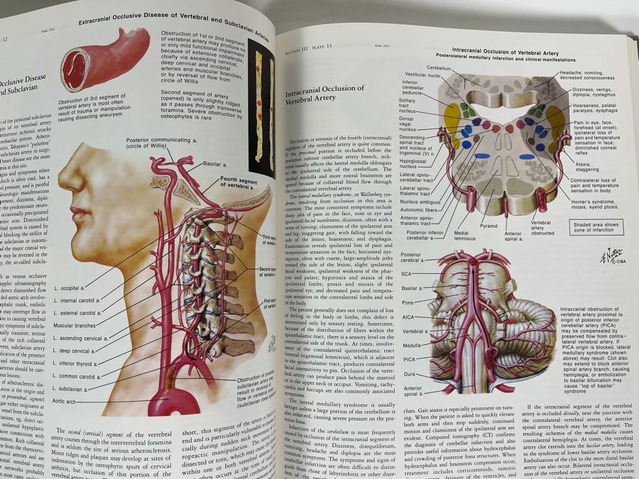 First Printing Pair Of Medical Books The CIBA Collection Of Medical Illustrations Volume I And II Nervous System: Anatomy And Physiology; Nuerologic And Neuromuscular Disorders [Photo 13]