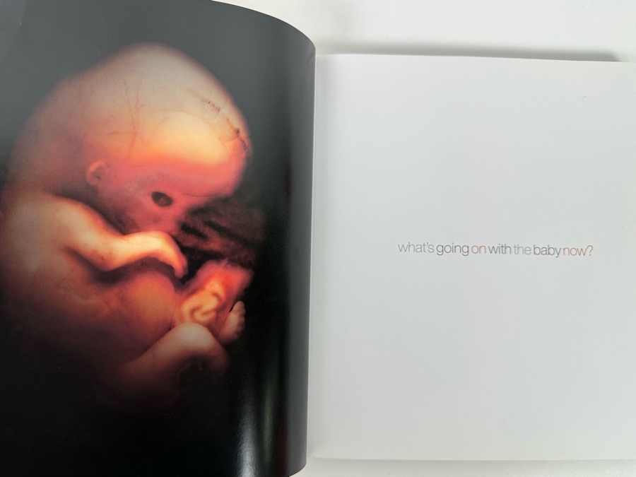 First Edition Hardcover Book From Conception To Birth A Life Unfolds By Alexander Tsiaras [Photo 2]