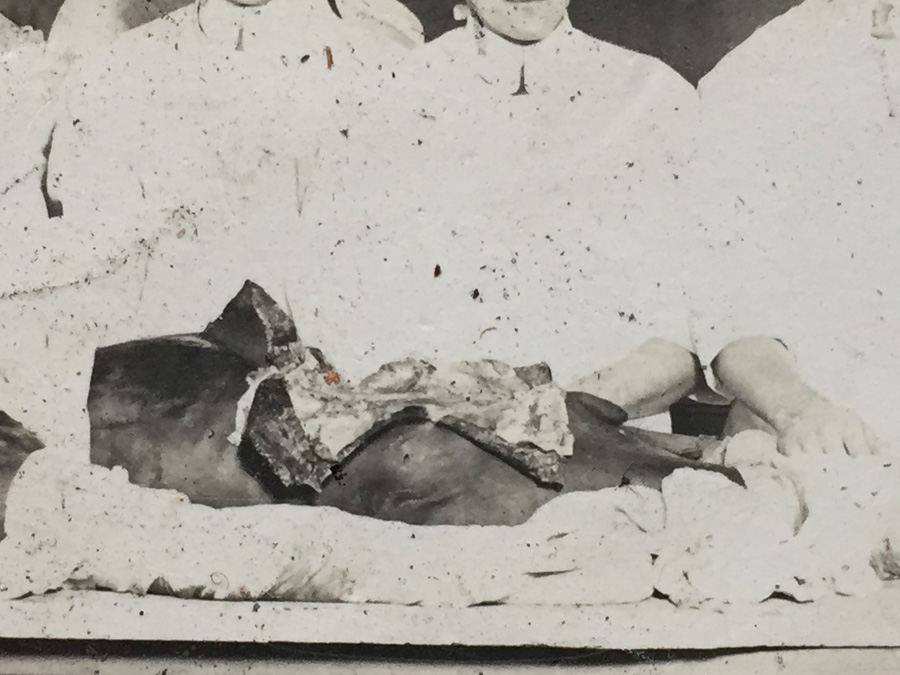 1914 Vintage Photograph Medical Students Cadaver Dissection [Photo 5]