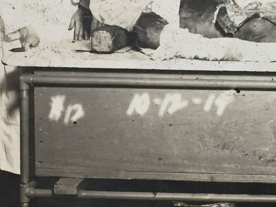 1914 Vintage Photograph Medical Students Cadaver Dissection [Photo 10]