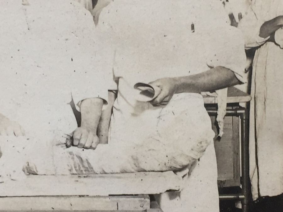 1914 Vintage Photograph Medical Students Cadaver Dissection