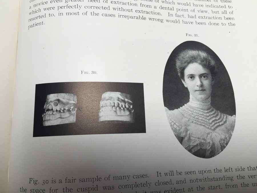 1908 Dental Orthopedia Book by Case - RARE [Photo 12]