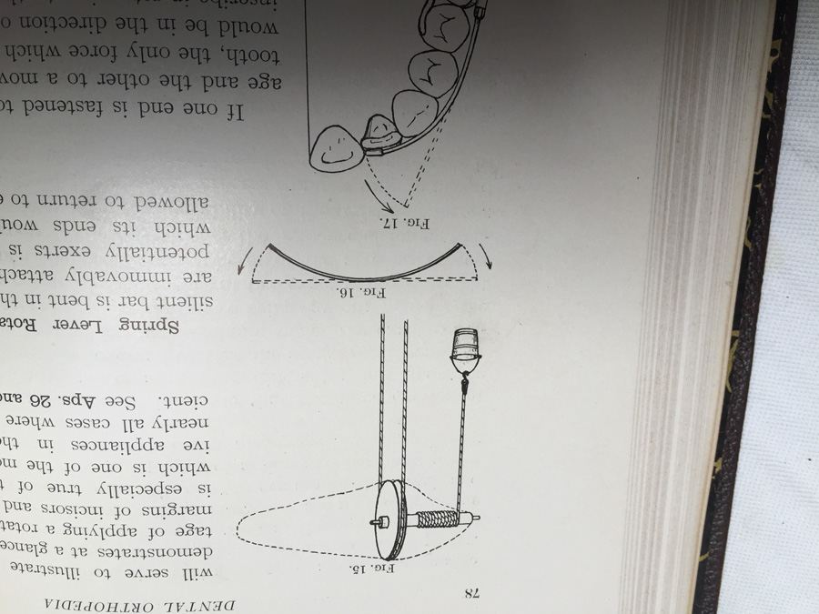 1908 Dental Orthopedia Book by Case - RARE [Photo 13]
