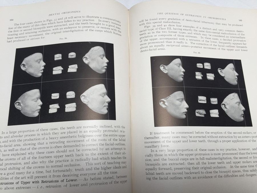 1908 Dental Orthopedia Book by Case - RARE [Photo 11]