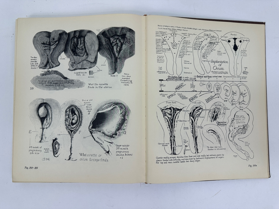 Just Added - Vintage 1949 Second Edition Hardcover Book Human Sex Anatomy By Robert Latou Dickinson A Topographical Hand Atlas [Photo 6]