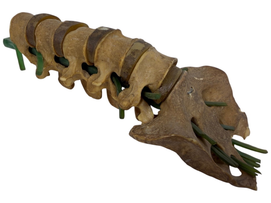 Educational Anatomical Model Of Human Lumbar Spine Vertebrae And Sacrum Featuring Intervertebral Discs And Green Tubing To Represent Spinal Nerve Roots 10'L