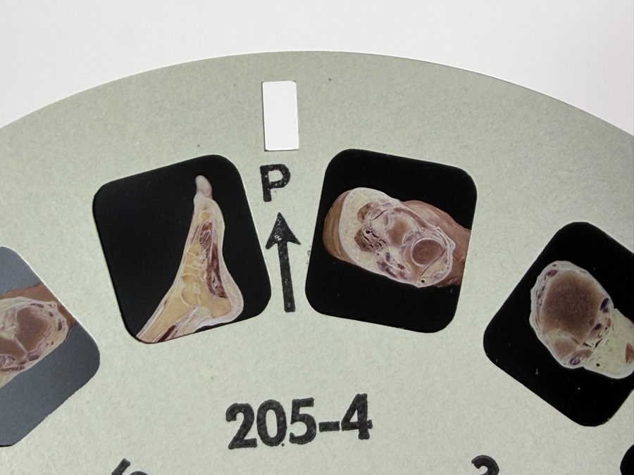 Rare Set Of (6) Vintage 1955 A Stereoscopic Atlas of Human Anatomy by David L. Bassett Upper and Lower Extremity View-Master Reels [Photo 14]