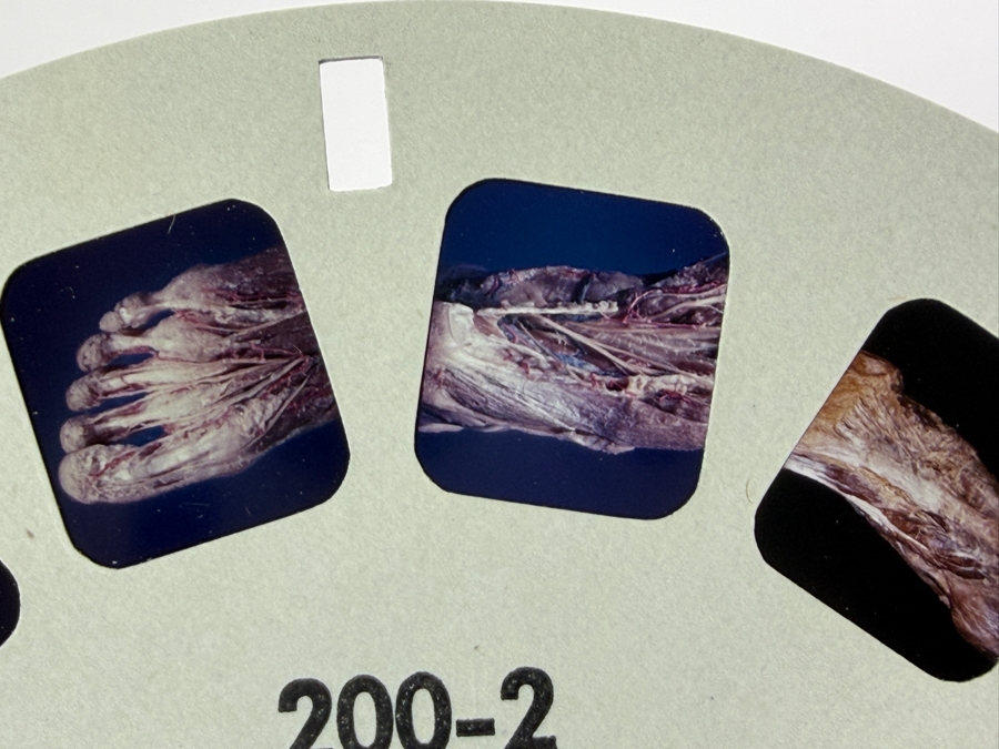 Rare Set Of (6) Vintage 1955 A Stereoscopic Atlas of Human Anatomy by David L. Bassett Upper and Lower Extremity View-Master Reels [Photo 13]